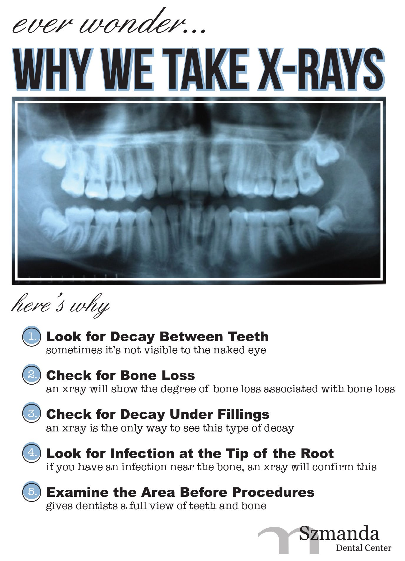 Xray Of Teeth